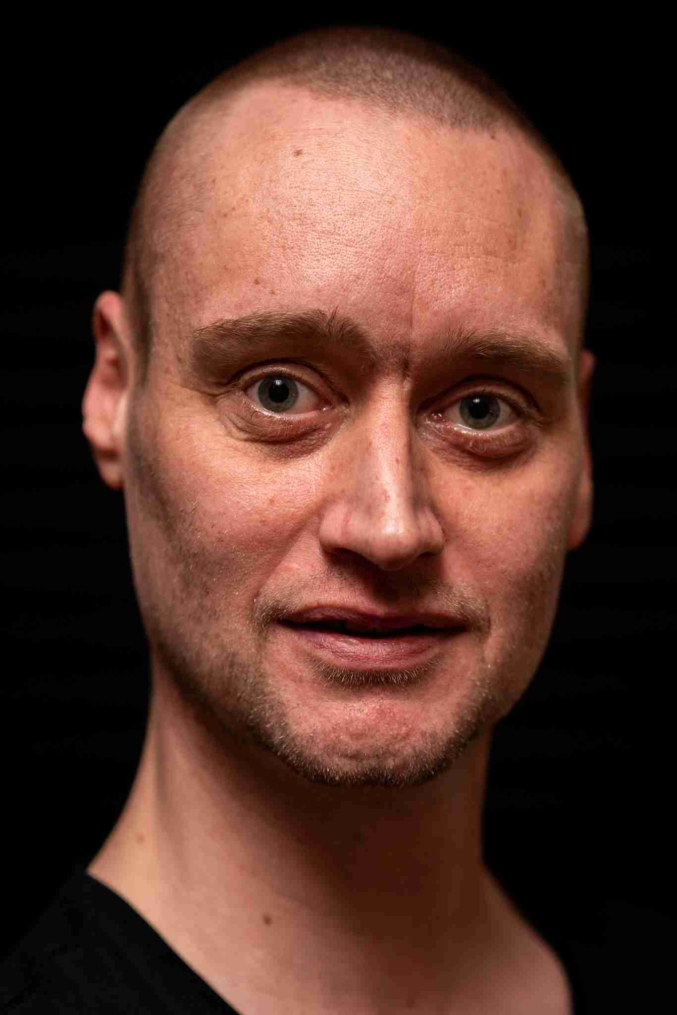 Read more about the article SPISEFORSTYRRELSE